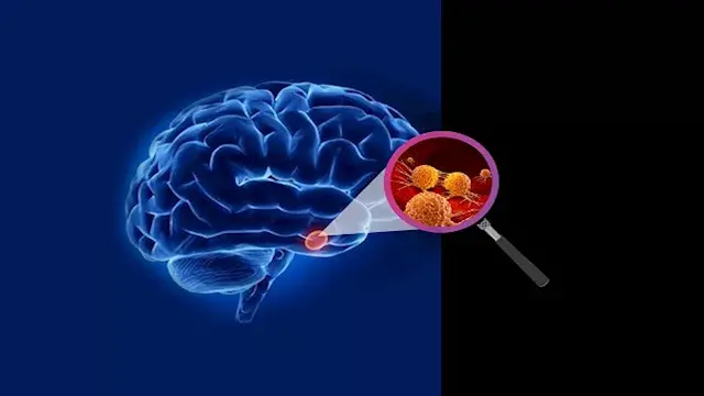 4 طرق فعالة لتقوية الذاكرة- عل...