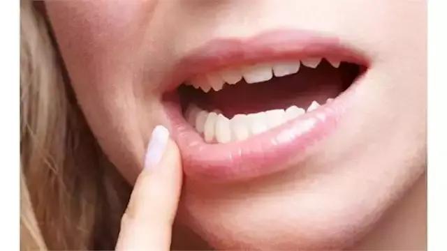 فحص بسيط في 5 دقائق قد يساعد ع...
