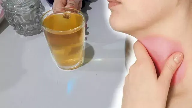 كيف تفرق بين التهاب الحلق العا...