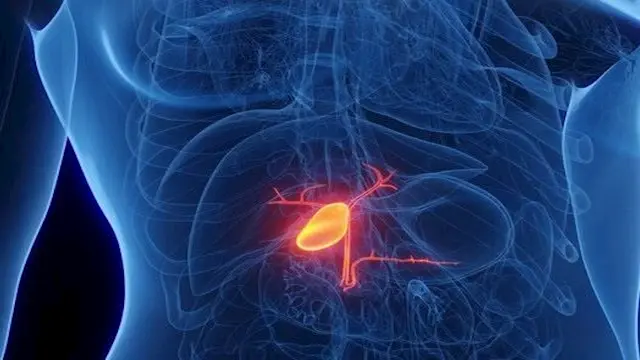 5 أعراض قد تكشف الإصابة بسرطان...