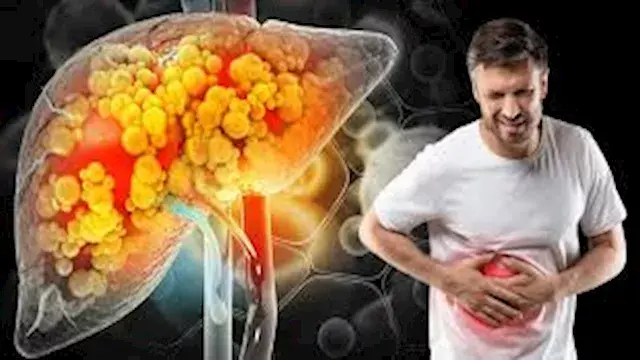 مرض الكبد الدهني.. مخاطر خفية...