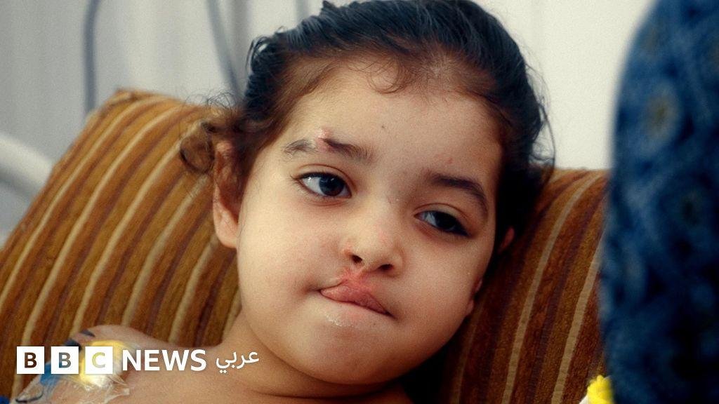 مخيمات تعج بالجرذان وجروح لا تلتئم: هكذا صارت الأوضاع في غزة