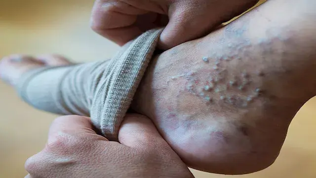 ما أسباب زيادة خطر الإصابة بـ...