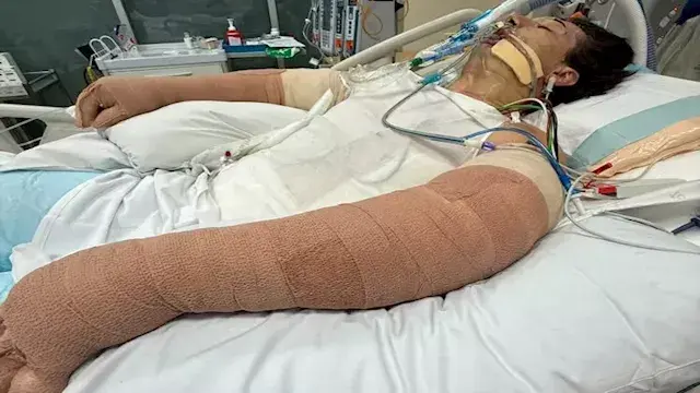رجل كاد أن يفقد حياته بسبب مكن...