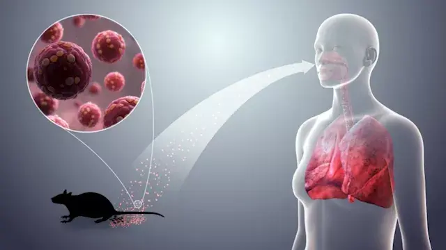 من جولة سياحية إلى حالة استنفار عالمية.. كيف انتشر فيروس هانتا؟