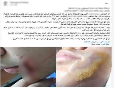 ضبط طفل تعدى على آخر بالضرب با...