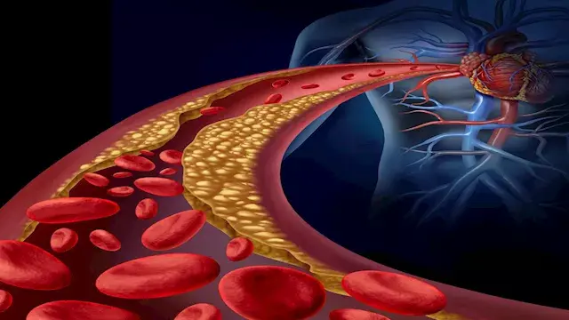 طعام "خارق" لصحة القلب.. طبيب...