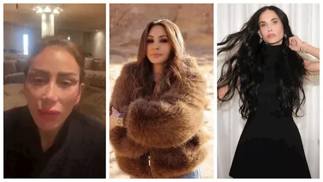 قبل وبعد.. 10 نجمات تغيرت ملامحهن بسبب التجميل