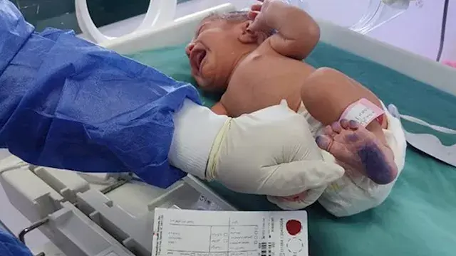فحص 735 ألف مولود.. ماذا قدمت...