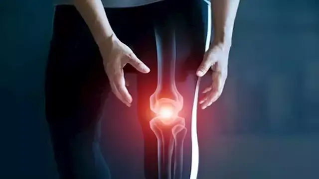 أفضل الأطعمة والمشروبات لصحة العظام والمفاصل.. احرص عليها