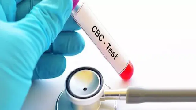 قبل تحليل الدم.. 3 أخطاء شائعة...