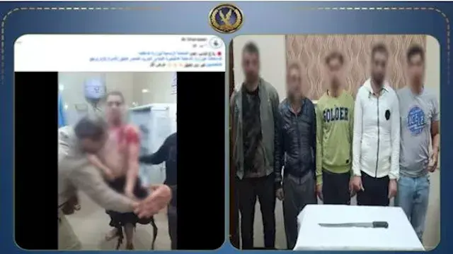 5 أشخاص يقتحمون منزلاً ويشوهون أسرة كاملة بـ "مادة حارقة" في البحيرة