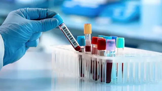 5 تحاليل قد تساعد على اكتشاف ا...