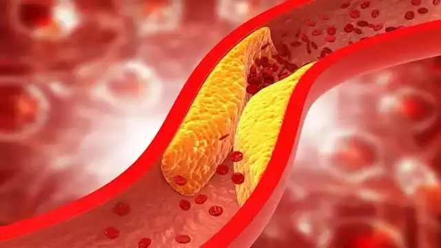 ماذا يحدث لدماغك عند ارتفاع مس...