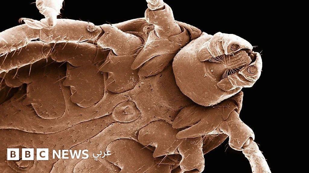 لماذا كلبي محمي أكثر مني من لدغات القراد؟ علماء يسعون لتطوير لقاح جديد للبشر قد يغيّر المعادلة