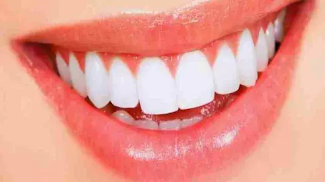 دراسة تحذر من مشروبات شائعة قد تدمر مينا الأسنان