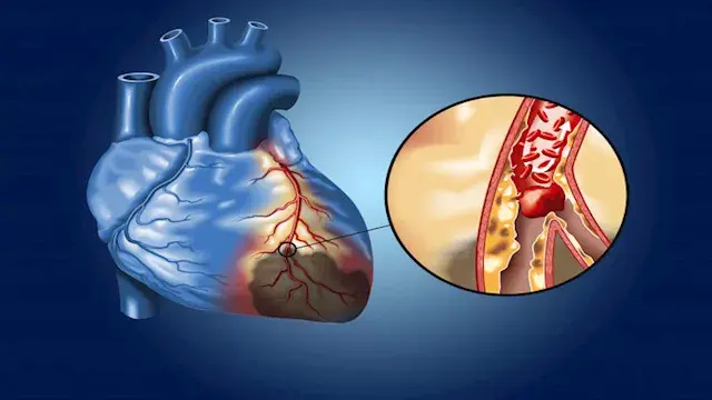 فاكهة تعزز صحة القلب والشرايين.. احرص على تناولها