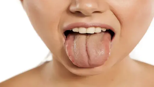 كيف تعرف أن جسمك يعاني من الجفاف؟