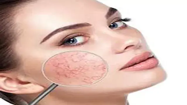 ليست مجرد عروق عابرة.. ماذا تق...