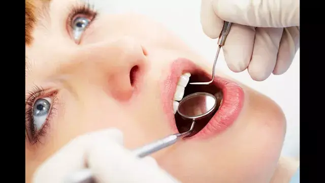 9 أعراض لسرطان الفم.. وهؤلاء أ...
