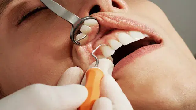 حلوى بوظيفة علاجية؟.. دراسة تك...