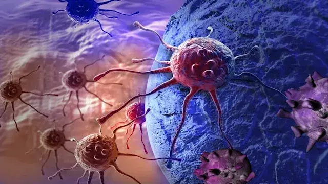 اكتشاف نوع رابع من السرطان ينت...