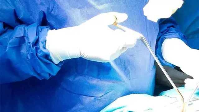 عملية معقدة بالفيوم تنتهي باستئصال ورم دون التأثير على نظر مريضة