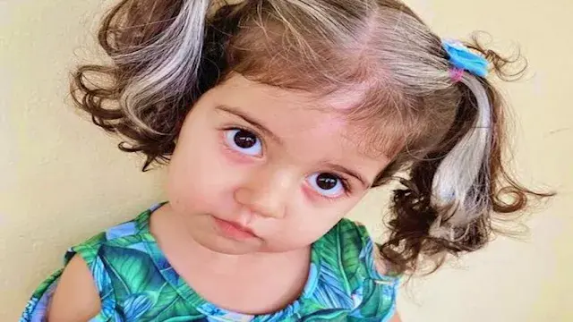 7 أسباب للشيب المبكر لدى الأطف...