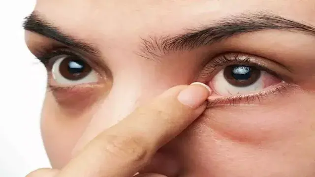 كيف يؤثر فقر الدم على عينيك؟.....